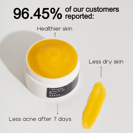Kill Acne & Redness