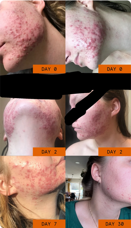 Before/After comparison